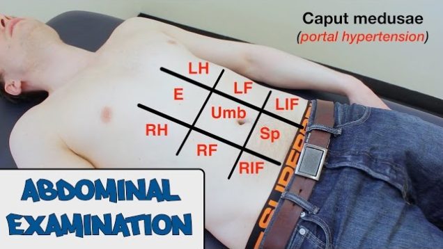 Abdominal Examination – OSCE Guide (New Version)