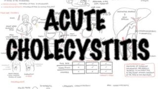 Acute Cholecystitis Overview