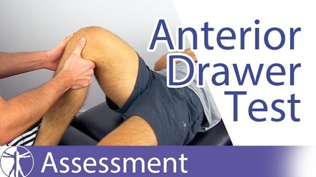 Anterior Drawer Test⎟Anterior Cruciate Ligament Rupture