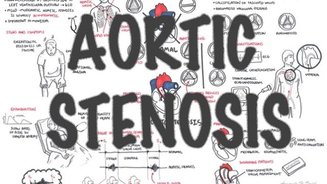 Aortic Stenosis – Overview