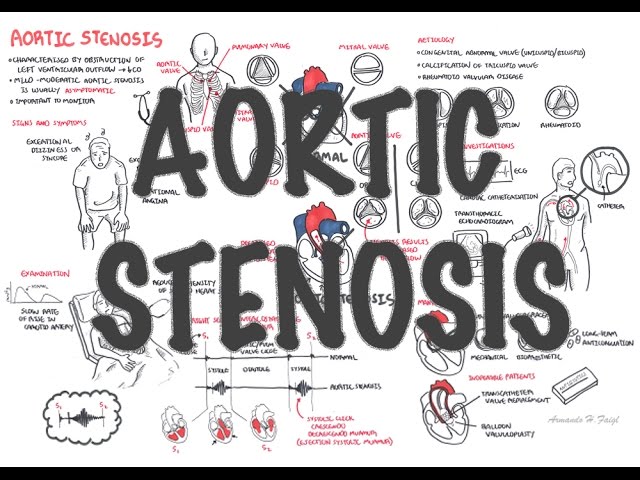 aortic-stenosis-medcomic-aortic-stenosis-pathophysiology-nursing