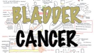 Bladder Cancer – Overview