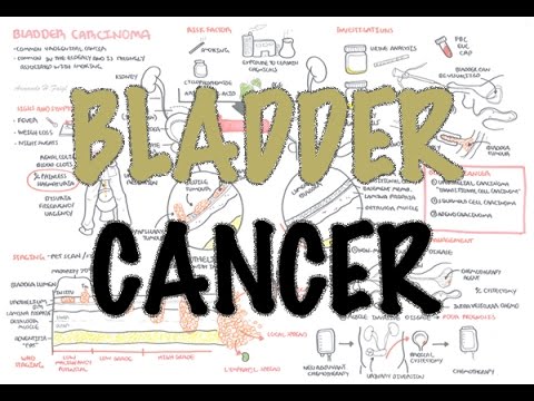 Bladder Cancer - Overview