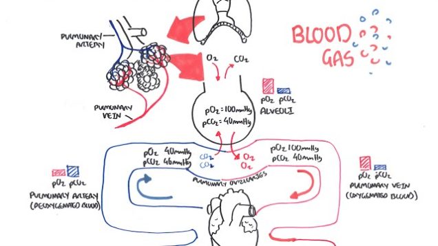 Blood Gases (O2, CO2 and ABG)