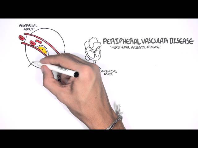  Cardiovascular Disease Overview 