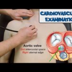 Cardiovascular Examination - (New Version)
