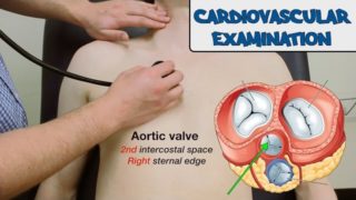 Cardiovascular Examination – OSCE Guide (New Version)