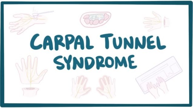Carpal tunnel syndrome – causes, symptoms, diagnosis, treatment & pathology