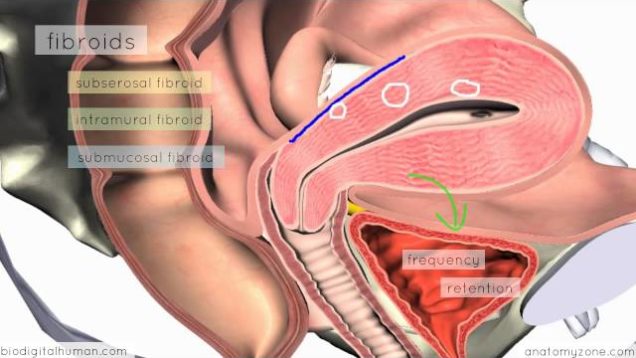 Clinical Reproductive Anatomy – Uterus – 3D Anatomy Tutorial
