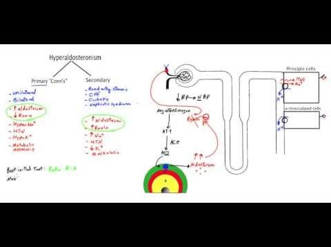 ✔ Conn’s syndrome (Primary Hyperaldosteronism) – MADE EASY