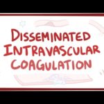 Disseminated intravascular coagulation - causes, symptoms, diagnosis, treatment, pathology
