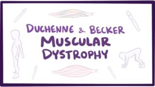 Duchenne & Becker muscular dystrophy – causes, symptoms, treatment & pathology