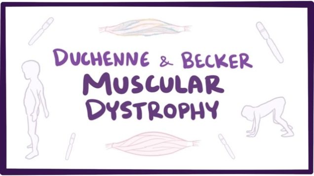 Duchenne & Becker muscular dystrophy – causes, symptoms, treatment & pathology