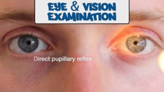 Examination of the Eyes and Vision – OSCE Guide