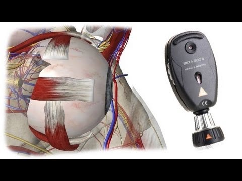 Fundoscopic Exam - Physical Exam - Free Medical Videos