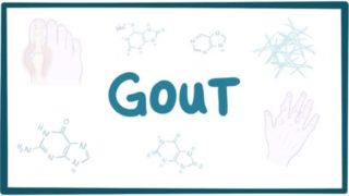 Gout – causes, symptoms, diagnosis, treatment, pathology