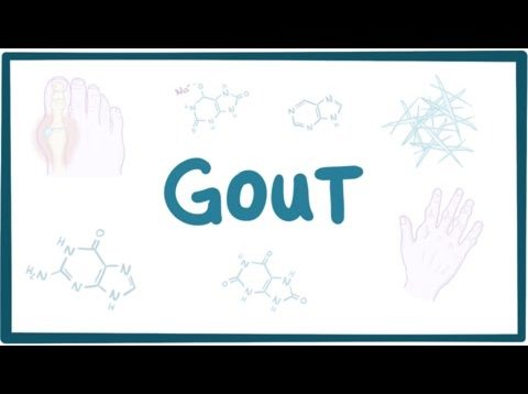 Gout – causes, symptoms, diagnosis, treatment, pathology