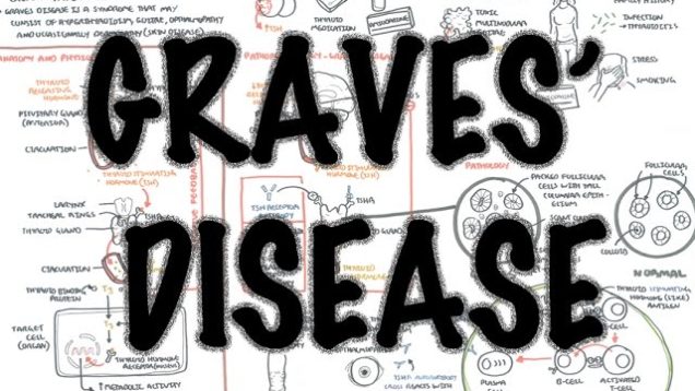 Graves Disease (DETAILED) – Overview