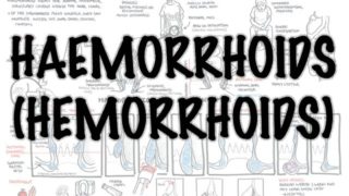 Haemorrhoids (Hemorrhoids) – Overview