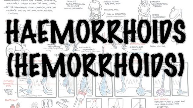 Haemorrhoids (Hemorrhoids) – Overview