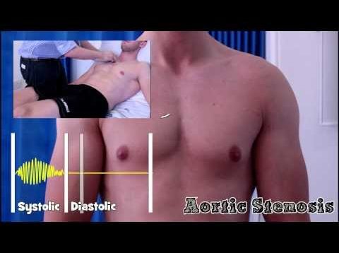 Heart Murmurs for Beginners