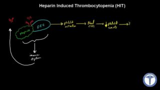 Heparin Induced Thrombocytopenia (HIT)