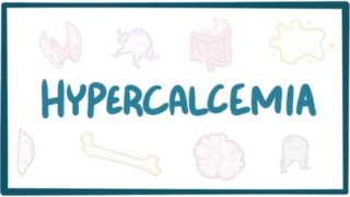 Hypercalcemia – causes, symptoms, diagnosis, treatment, pathology