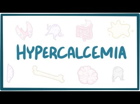 Hypercalcemia – causes, symptoms, diagnosis, treatment, pathology