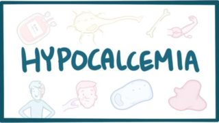 Hypocalcemia – causes, symptoms, diagnosis, treatment, pathology