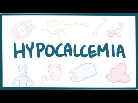 Hypocalcemia – causes, symptoms, diagnosis, treatment, pathology