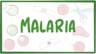 Malaria – causes, symptoms, diagnosis, treatment, pathology