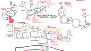 Microbiology – Helicobacter Pylori (Ulcer)
