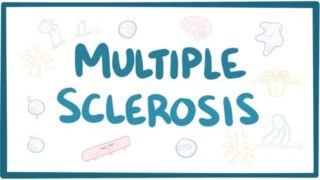 Multiple sclerosis – causes, symptoms, diagnosis, treatment, pathology