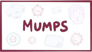 Mumps – symptoms, diagnosis, treatment, pathology