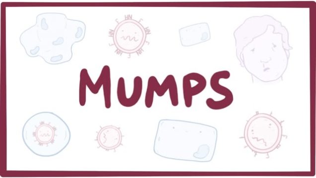 Mumps – symptoms, diagnosis, treatment, pathology