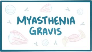 Myasthenia gravis – causes, symptoms, treatment, pathology