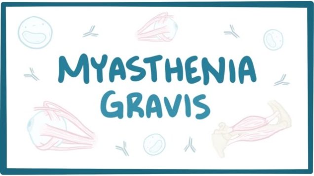 Myasthenia gravis – causes, symptoms, treatment, pathology
