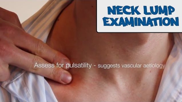 Neck lump examination – OSCE Guide (New Version)
