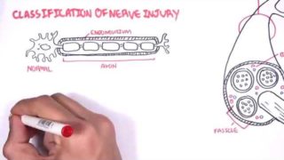Neurology – Nerve Damage and Regeneration