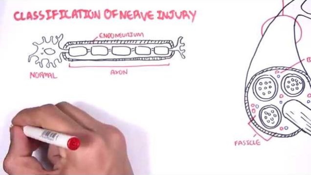 Neurology – Nerve Damage and Regeneration