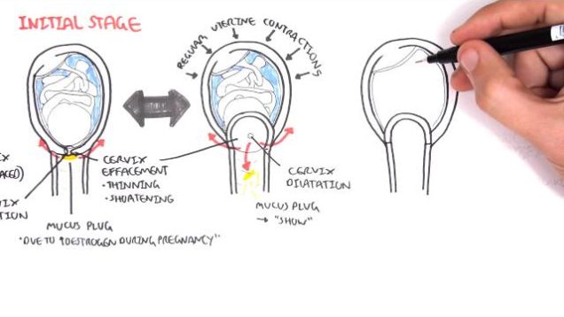 Obstetrics – Stage I of Labour