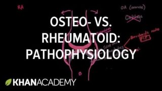 Osteoarthritis vs rheumatoid arthritis pathophysiology | NCLEX-RN | Khan Academy