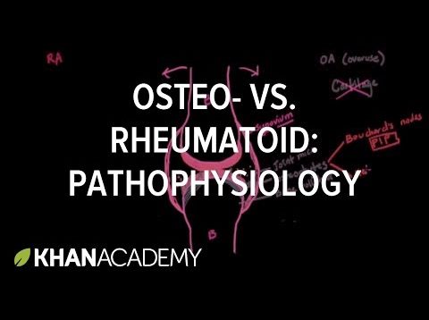 Osteoarthritis vs rheumatoid arthritis pathophysiology | NCLEX-RN | Khan Academy