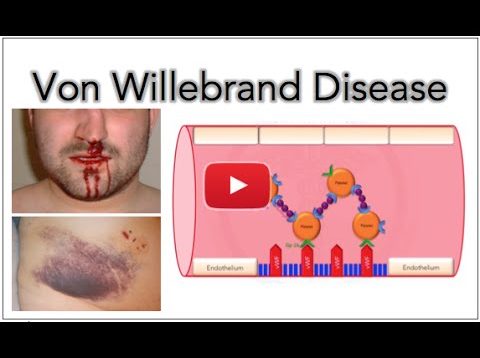 von Willebrand disease – Platelet adhesion and aggregation – Medical Institution – Free Medical Videos – Dr. Ali Feili MD