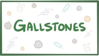 Gallstones (cholelithiasis) – causes, symptoms, diagnosis, treatment & pathology