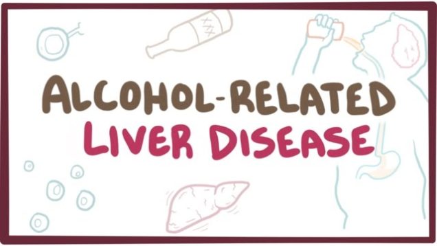 Alcohol-related liver disease – causes, symptoms & pathology