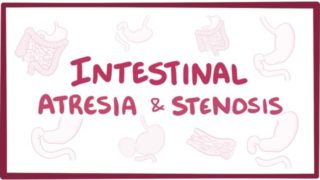 Intestinal atresia & stenosis – causes, symptoms, diagnosis, treatment, pathology