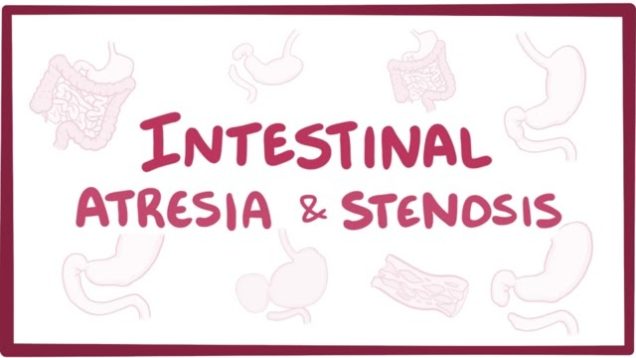 Intestinal atresia & stenosis – causes, symptoms, diagnosis, treatment, pathology