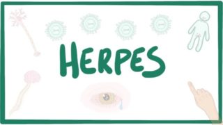 Herpes (oral & genital) – causes, symptoms, diagnosis, treatment, pathology