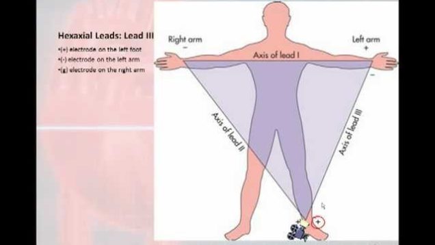 12 Lead Interpretation Part 1: Introduction to the 12 Lead EKG